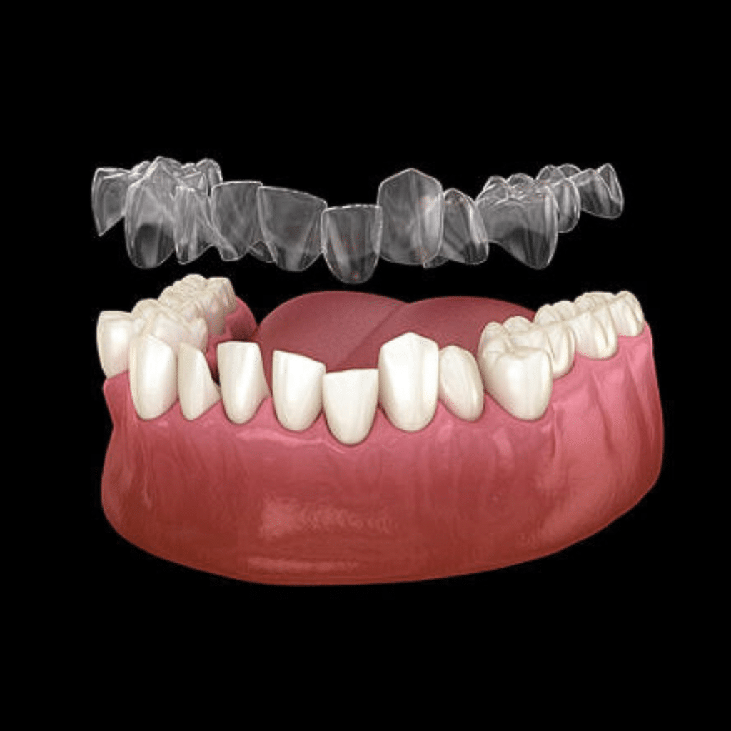 Formation sur les aligneurs invisibles réalisée par nos orthodontistes à Paris le 6 juin 2024 et à destination des chirurgiens-dentistes