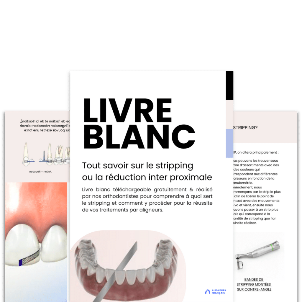 Tout savoir sur le stripping dentaire, conseils et astuces de nos orthodontistes - Livre Blanc téléchargeable gratuitement