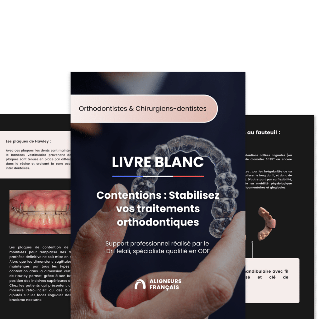 Livre blanc Contentions - Aligneurs Français : Nos orthodontistes vous partagent tous les conseils pour stabiliser vos traitements
